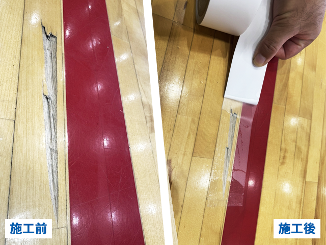 ささくれの画像